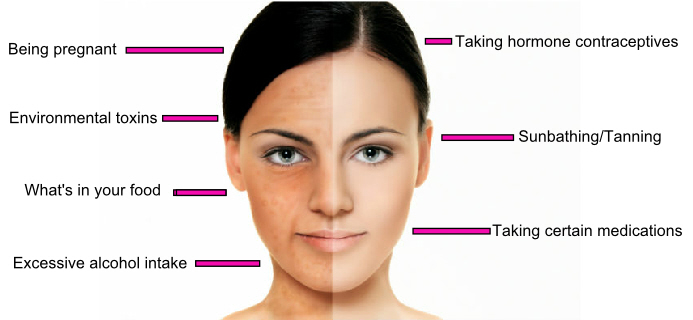 7 secret reasons your skin pigment changes colour - Healthista