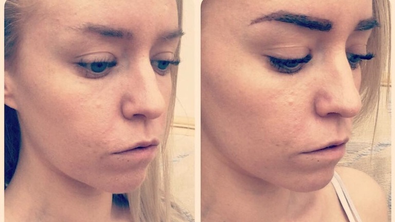 before and after, lola brow review, by healthista