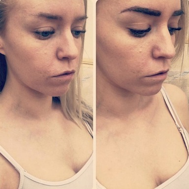 my-before-and-after-lola-brow-review-by-healthista