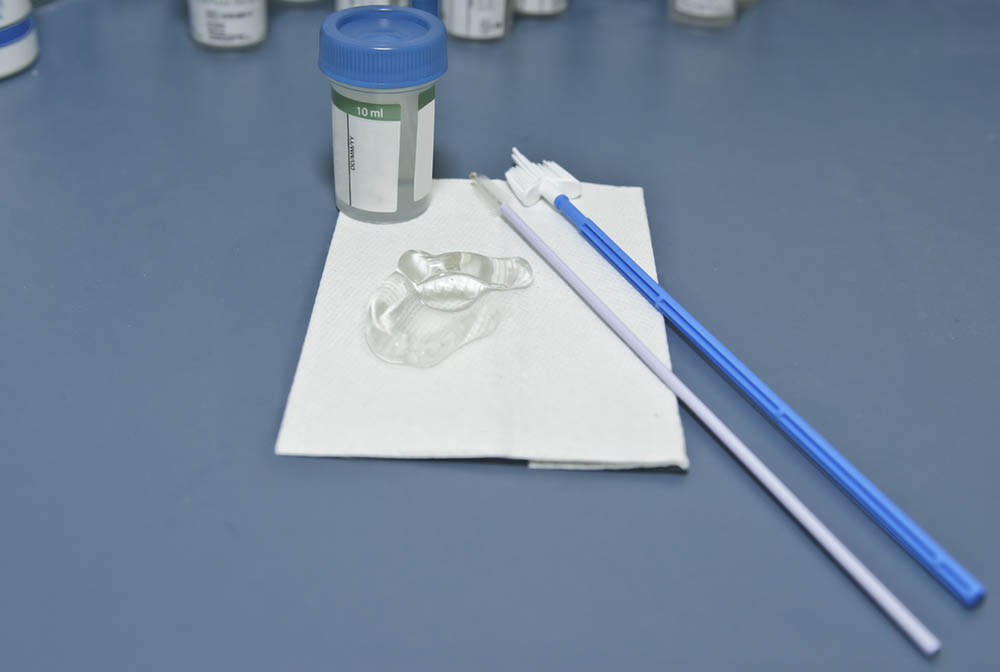 pap smear medical test