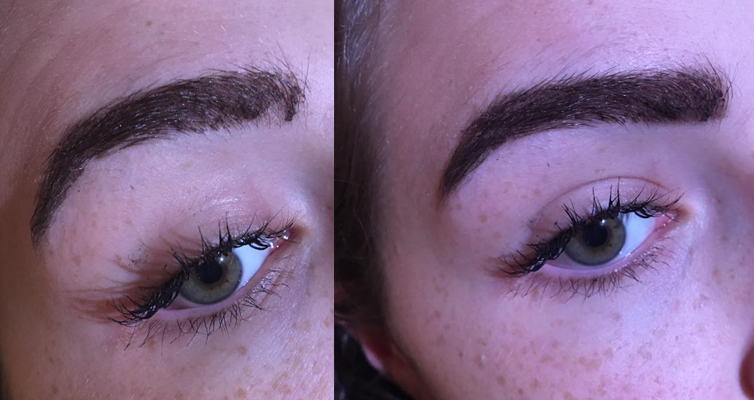 Vanessa brow before and after, Best 3 eyebrow treatments you need to know for a brow transformation by healthista