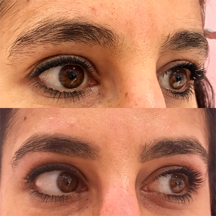 Yanar before and after eyebrows, 3 best eyebrow treatments you need to know for a transformation by healthista