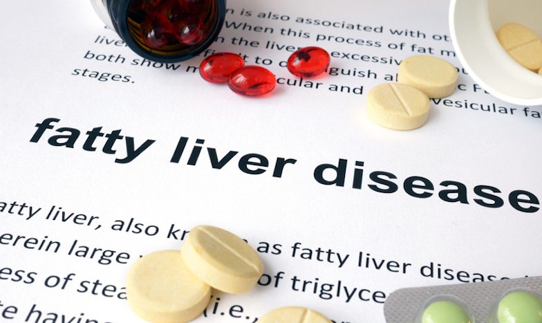 Tired? Bloated? Skin dry and itchy? You might have fatty liver Healthista