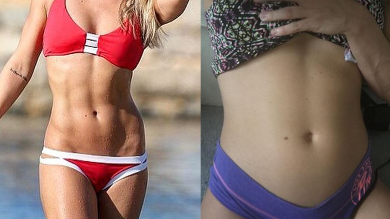 chloe madeley before and after main image, the little pill that fixed my bloating problems by healthista