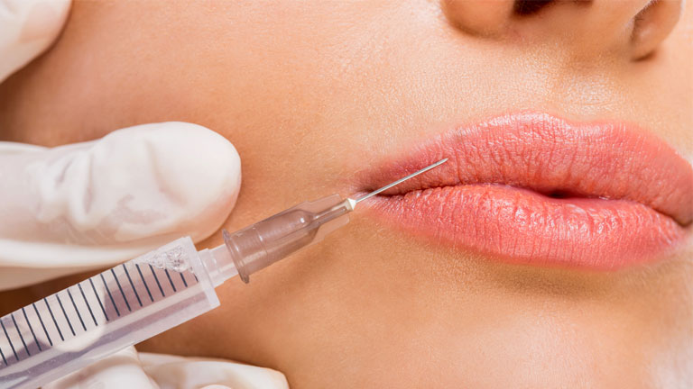 lip-fillers,-what-are-lip-fillers--ask-the-dermatologist-by-healthista.com