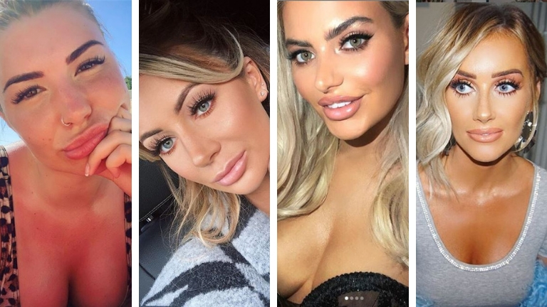 LIPS CELEBS LOVE ISLAND