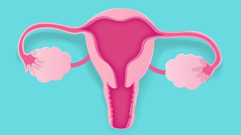 pcos ask the gynae