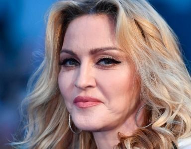 botox and filler - madonna - featured