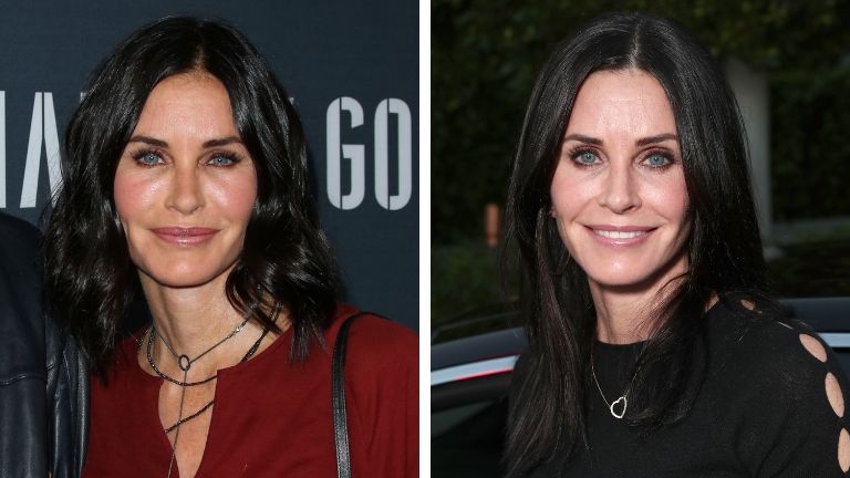 injectables - courtney cox before and after 