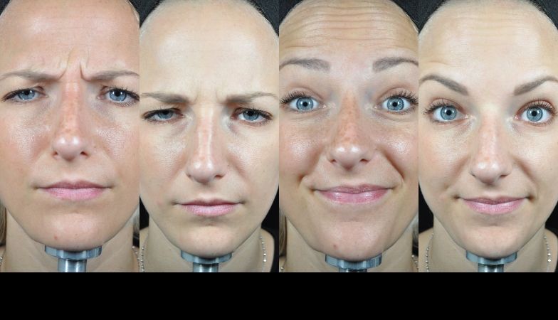 The new Baby Botox – this is exactly what happens to your face