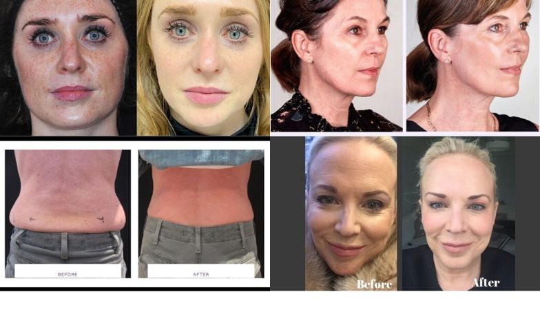 10 new anti-ageing treatments and exactly what their results look like