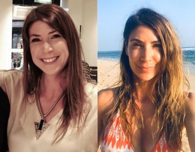 Hair loss - 'Wedding stress made my hair fall out - here's how I got it back' - Healthista Hair loss - 'Wedding stress made my hair fall out - here's how I got it back' - Healthista