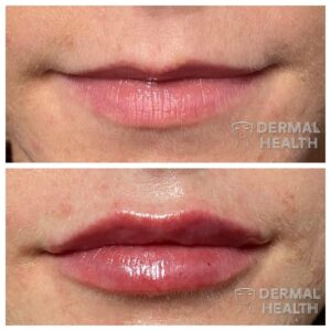 beautiful lips case study