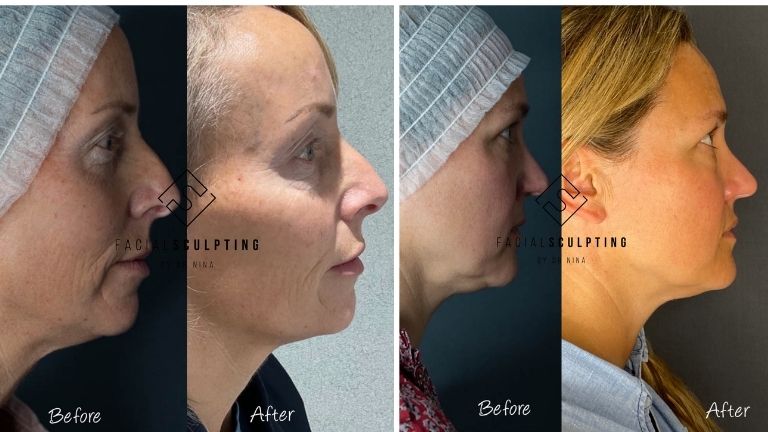 E4’s Body Fixer Dr Nina Bal reveals results of her miracle non-surgical ...