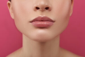 5-surprising-things-you-can-treat-with-Botox-smooth-chin.jpg