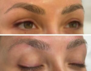 Does eyebrow tattoo removal hurt Here's what you need to know featured