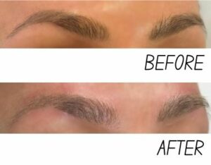 Eyebrow Tattoo Removal Melbourne Victoria  Eye Art Studio