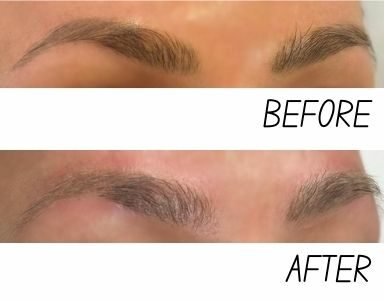 Does eyebrow tattoo removal hurt Here's what you need to know featured