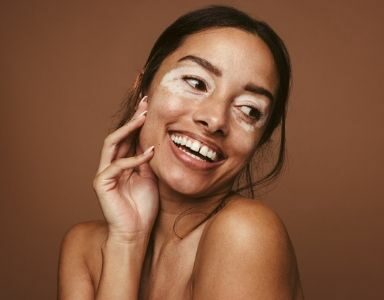 Melasma, freckles & SPF - 6 ways to care for your skin in time for Summer FEATURED