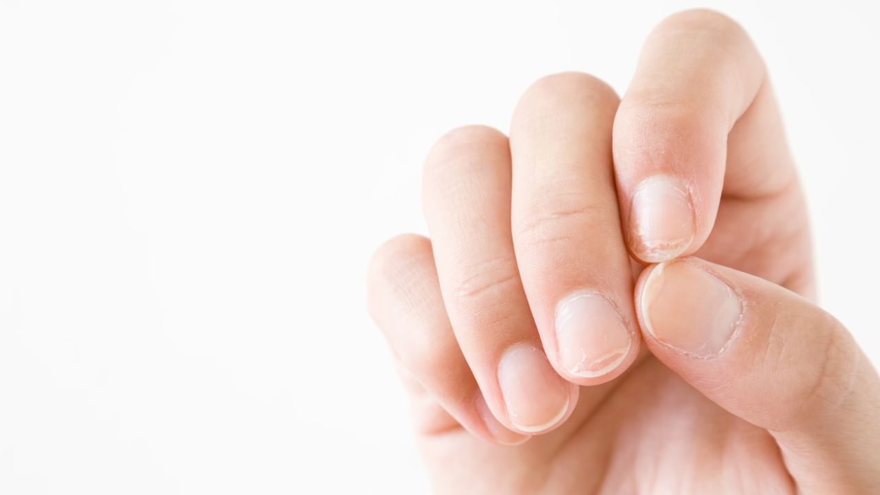 Brittle Thin Nails? Here Are 3 Awesome Remedies! - Faiza Beauty Cream