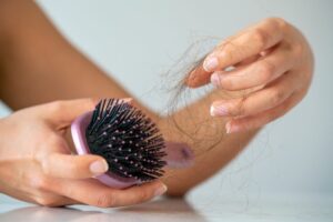 hair loss woman holding hair brush