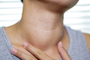 THYROID-HEALTH-GOITER-NECK.jpg