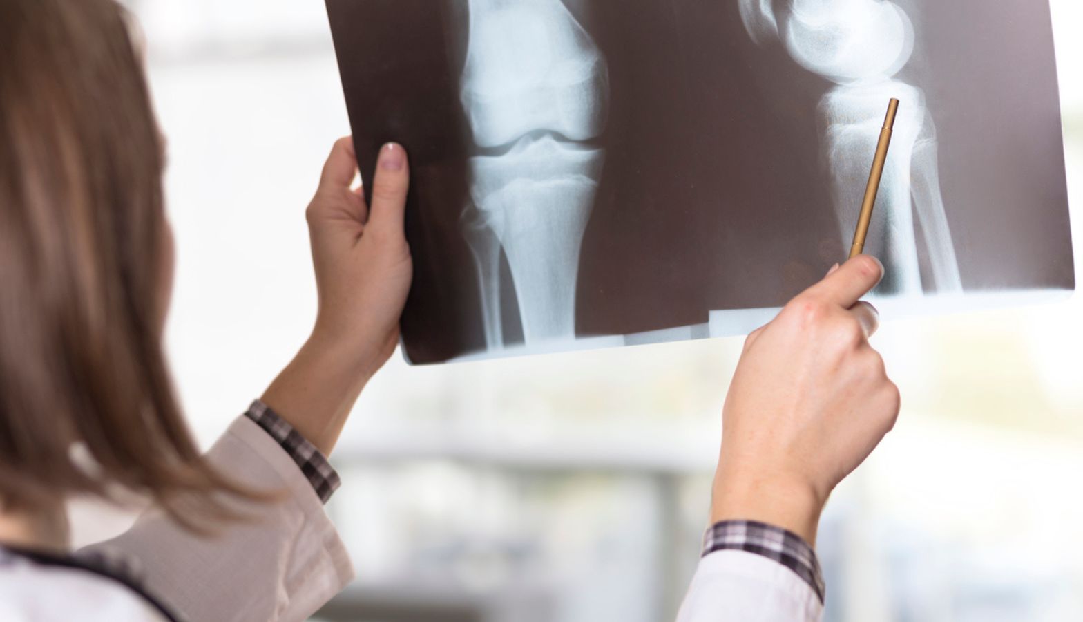 Are you at risk of osteoporosis? 3 ways to keep your bones healthy