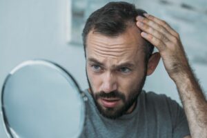 hair loss male pattern baldness