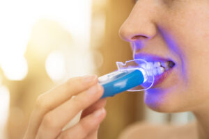 teeth-whitening-at-home-.jpg 